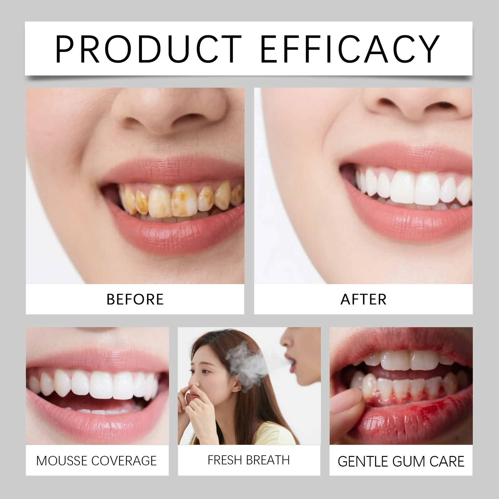 Tiras clareadoras v34